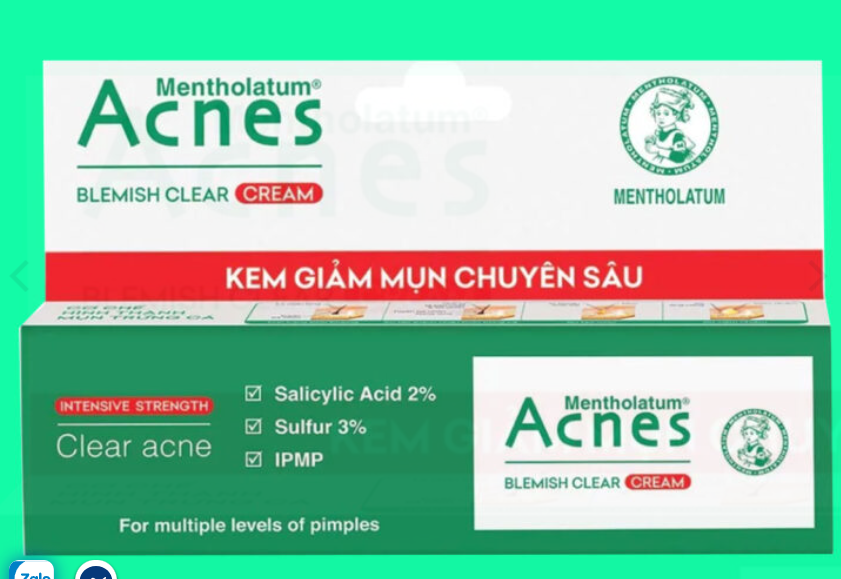 Acnes Blemish Clear Cream Rohto Trị mụn (Tuýp/10g)